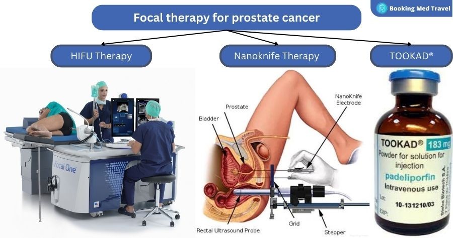 Vascular-targeted photodynamic therapy with TOOKAD®